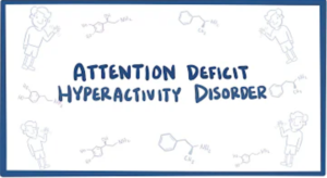 Treatment of Attention Deficit Hyperactivity Disorder